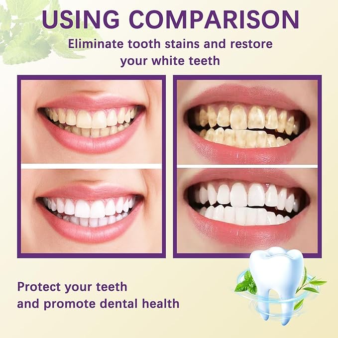 Teeth Whitening Toothpaste - Gently removes stains, freshens breath, and protects tooth enamel (1 pcs)
