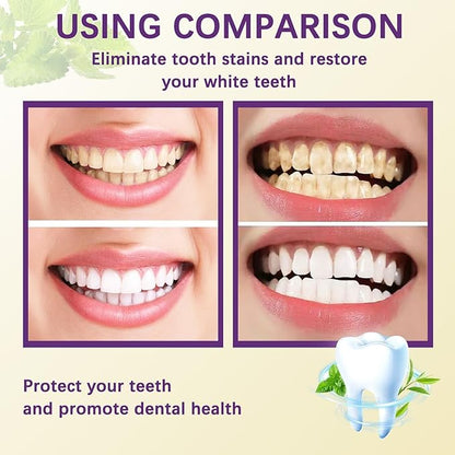 Teeth Whitening Toothpaste - Gently removes stains, freshens breath, and protects tooth enamel (1 pcs)